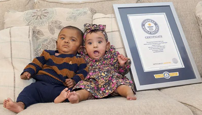 twins guinness record